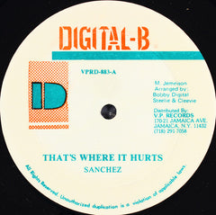 Sanchez : That's Where It Hurts (12", Single)